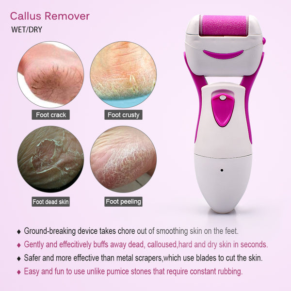 Electric Dead Skin Remover