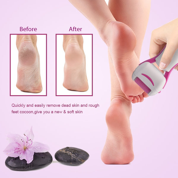 Electric Dead Skin Remover